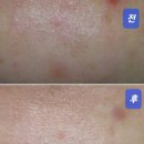세로파민 유산균 내돈내산 후기: 스트레스, 피부트러블, 수면까지 한 번에?