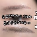 강동-길동-181 | 천호 눈썹문신제거 투브로우즈아카데미 강동점 붉은잔흔제거 대만족 후기