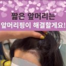 마이크로헤어증모 이미지