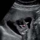 서울봄산부인과의원 이미지