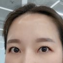 리코래쉬