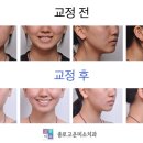 서울고운미소치과교정과치과의원 이미지