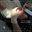 천안 아기 구강검진 시기 친절한 참조은치과병원 무료 솔직후기