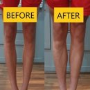 바디라이프 이미지