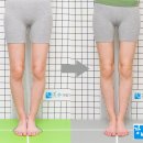 오다리교정병원 - 좌우비대칭의 내회전성 오다리교정 내반슬 휜다리 도수치료 교정치료 전후비교