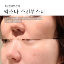 엑소엑소 | 창원 스킨부스터 엑소나 후기｜엑소좀 관리 효과와 3주간 피부 변화 기록