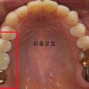 허브치과 이미지