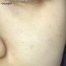 정음스킨케어 | 구달 비타씨 잡티세럼 썸머 리미티드 에디션 사용하여 생기있는 피부 만들기