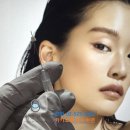 수아연한의원 미세조정 매선침 리프팅만의 특징 2가지(멍붓기 안보이게 OK l 후기확인)