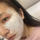 강남역 피부과 추천 포텐자 시술 + 연어주사