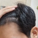 모디헤어플란트의원 이미지