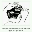 피부에 묻은 염색약 지우는 방법 이미지