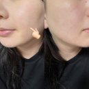 송송약국 | [ 유노아 시카 엑소좀 53 케어샷 앰플 ] 약국입점 모공쫀쫀 후기