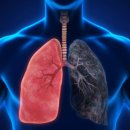 유엔아이메디컬 이미지