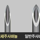정관마취통증의학과의원 네이버블로그