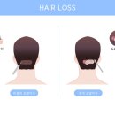 모모성형외과의원 이미지