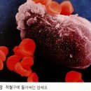 황제쑥뜸 이미지