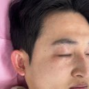 송뷰티에스테틱 | 수원 미작뷰티 | 남자 피부관리 기미·잡티 제거 후기