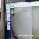 신세계한의원 | 강남 큐어람한의원 얼굴 편평사마귀 제거 후기/부작용