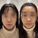라벤더포차 | [채애움뷰티] 잠자는숲속공주가 된 느낌🩷 프라이빗한 공간에서 받는 서대문구윤곽전문 관리샵