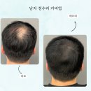 디블랙 | 김천두피커버 디블랙아카데미 김천점 방문 후기, 당신의 두피 고민 해결!