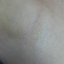 썬아이래쉬 | [광명/왁싱/라이콘왁싱] 광명 왁싱샵 썬아이래쉬 겨드랑이 왁싱 후기!!