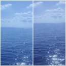 세정상사 | 20대 망막박리 공막돌륭술 1개월차 후기(재수술)