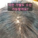 송화2길 | 구미/왜관 가발수선 전문 송화가발- 인모 부분가발 완벽 수선 후기