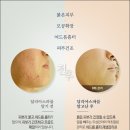 건강한 피부샵