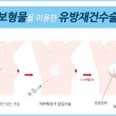 유방 이미지