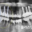 플러스덴치과의원 이미지