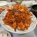 20대 여자 혈변/ 대학생 치질 치루ㅋ / 항문외과 검사후기
