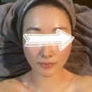 [ 이태원마사지 ] 피부에 과일을 주는 여자 보광동 이촌 작은얼굴 연구소