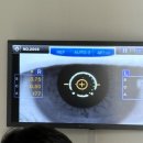 루미의 아이톡 안경원 이미지