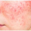 일독한의원 이미지