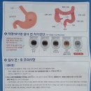 연세항맥병원 | 대장 내시경 오라팡 복용 후기 (일산 연세 항맥 병원)