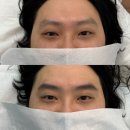 초잉브로우 | [눈썹컨설팅] "서울대입구 초잉브로우" 후기 💆🏻‍♀