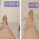 아시아드 메디칼 빌딩 | 거제동에스테틱 청담뷰티센터 새단장 오픈 하체 슬리밍 관리 후기