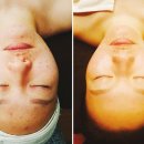 태후바디케어 네이버블로그