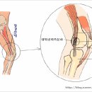 [ 장경인대 증후근 (장경인대염) ] - 모두들 주의 하세요 ^^; 이미지