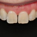 연세화이트치과의원 이미지