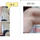 에이스원 이미지
