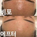 에스와이 | [분당피부관리] 문제성 피부 전문 에스와이뷰티크 리얼 후기✨