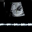 다정산부인과의원 | 판교 산부인과 조아 산부인과의원, 20주차 임산부의 든든한 서브병원 진료 후기