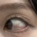 혜안서울안과의원 이미지