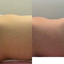 부천에스테틱 소녀감성 원장님과수다하며 복부관리 귀족뷰티 피부관리실