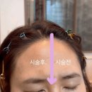 두언니헤어 | 상무지구왁싱 보보뷰티아뜰리에광주본점 헤어라인왁싱 직접보고온 솔직후기