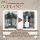 재생플란트치과의원 이미지