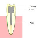 엔도코어 이미지