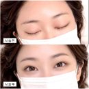 디자인세종 | 세종눈썹문신 자연스러운 디자인 리메이드 대전점 후기